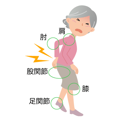 肩・肘・股関節・膝・足関節の症状のイラスト